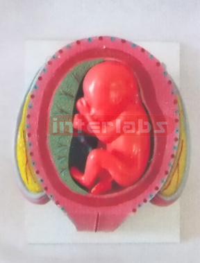 UTERUS WITH EMBRYO (6 MONTH)